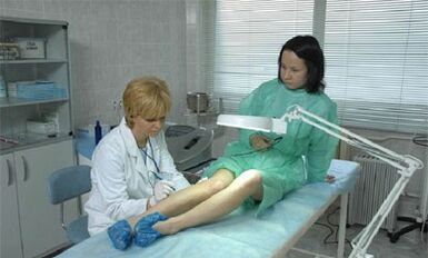 como tratar varizes nas pernas