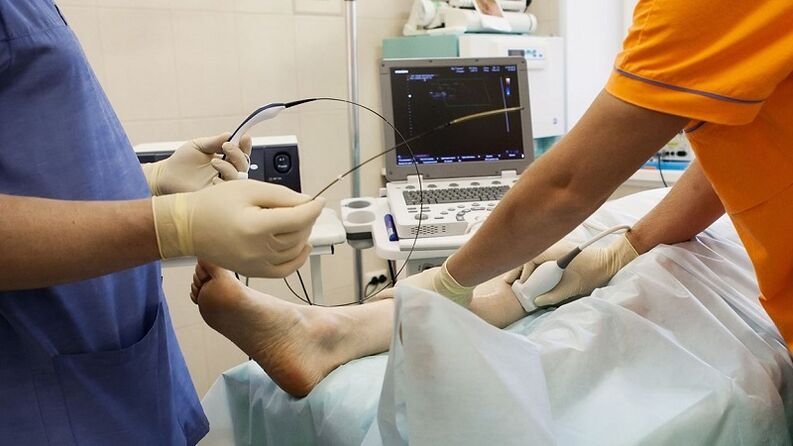 cirurgia para remover varizes