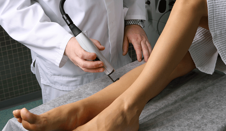 tratamento a laser para varizes